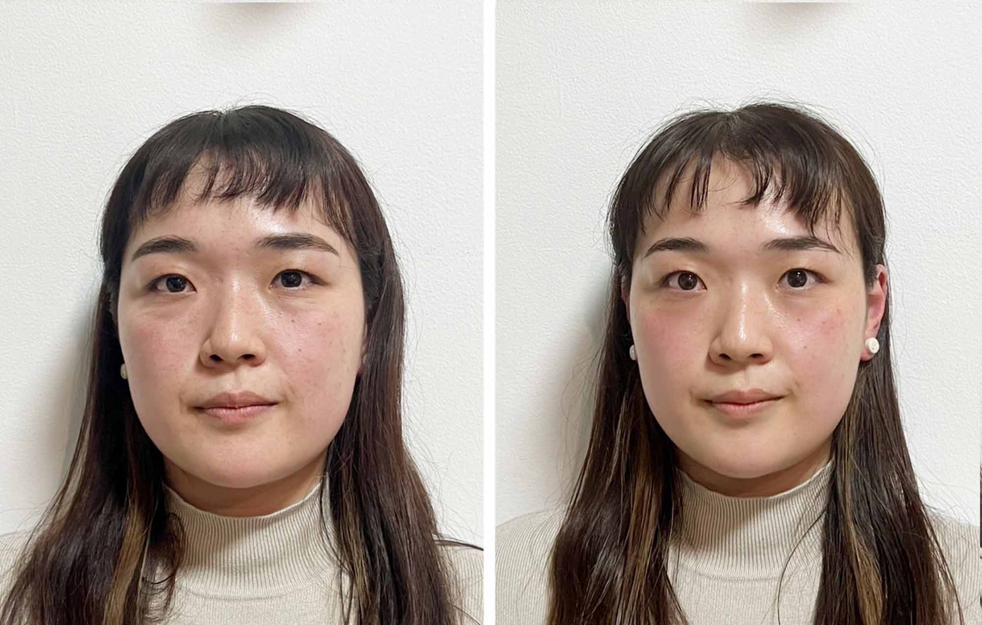 エステサロン・グルニエのフェイスエステ・ビフォーアフター