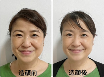 神奈木流体バランス法に 造顔メニューを受けられたお客様の顔の変化