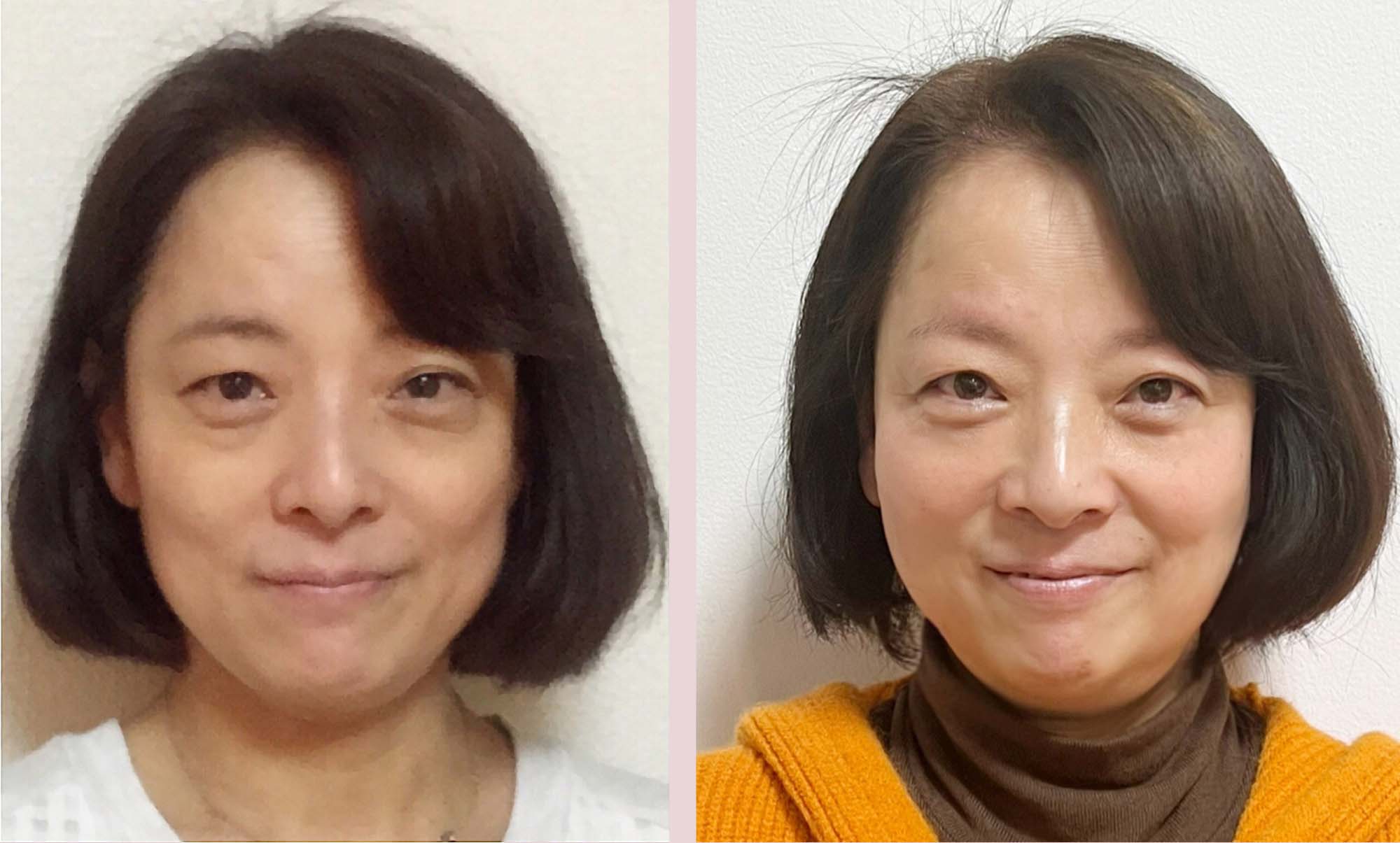 アトピーがひどくて 若い頃から悩んでましたが 今が一番お肌が 綺麗です